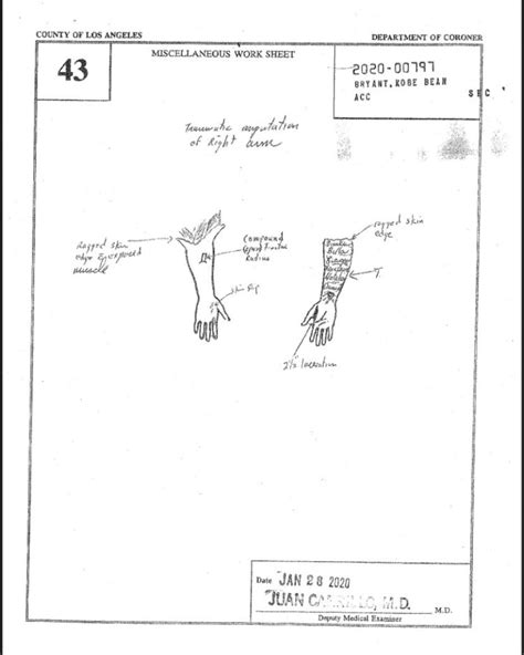 kobe and gigi autopsy picture|Kobe Bryant, Gigi Autopsy Sketch Photos Cause。